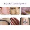 Organic Skin Tags Solutions Serum-9658-01