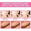 Organic Skin Tags Solutions Serum-9654-01