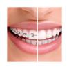 AMFLOR Best Toothpaste For Braces -5222-01