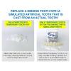 Instant Smile Temporary Tooth Kit-9659-01