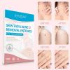 Painless Skin Tags Acne Removal 108Pcs-6916-01
