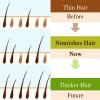 7 Days Ginger Germinal Natural Hair Loss Treatment Hair Oil-10877-01