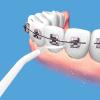 Power Floss Dental Cleaner-8857-01