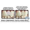 Instant Smile Temporary Tooth Kit-9660-01