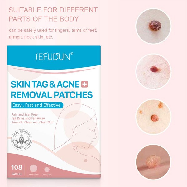 Painless Skin Tags Acne Removal 108Pcs-6919
