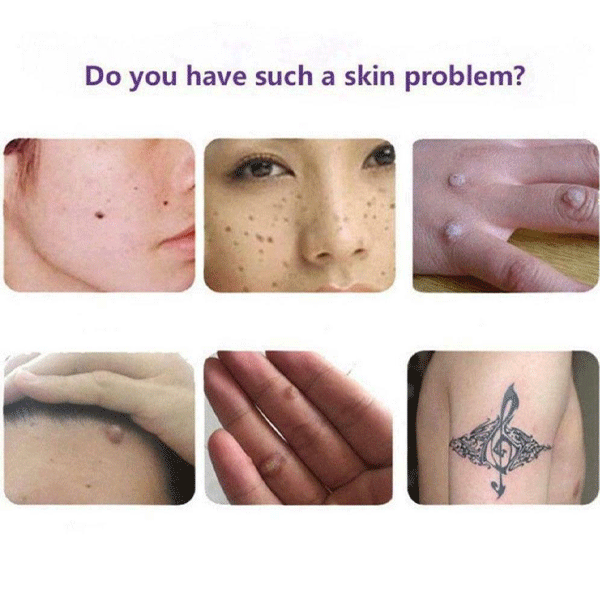 Organic Skin Tags Solutions Serum-9658