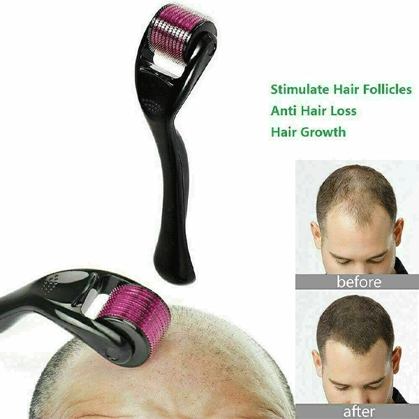 Neo Hair Lotion With Titanium Hair Growth Roller-10874