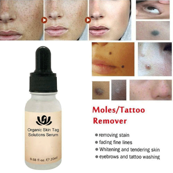 Organic Skin Tags Solutions Serum-9657