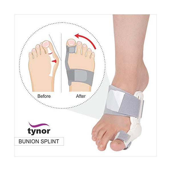 TYNOR Orthopedic Bunion Splint Toe Corrector- 2pcs-4786