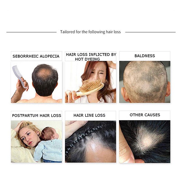 Disaar Anti Hair Loss Essential Oil 30gm-7985