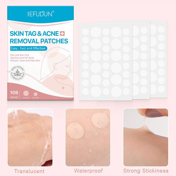 Painless Skin Tags Acne Removal 108Pcs-6917