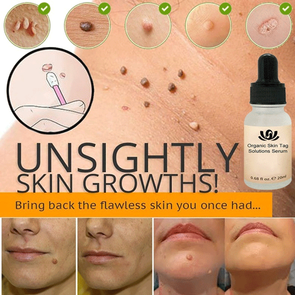 Organic Skin Tags Solutions Serum-9655