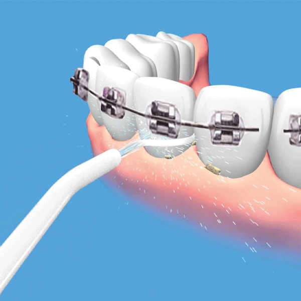 Power Floss Dental Cleaner-8857