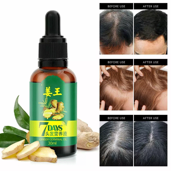 7 Days Ginger Germinal Natural Hair Loss Treatment Hair Oil-10958