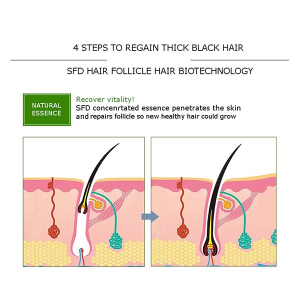 Disaar Anti Hair Loss Essential Oil 30gm-7980
