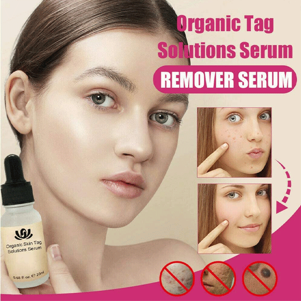 Organic Skin Tags Solutions Serum-9651