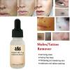 Organic Skin Tags Solutions Serum-9657-01