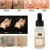 Organic Skin Tags Solutions Serum-9656-01