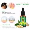 7 Days Ginger Germinal Natural Hair Loss Treatment Hair Oil-10960-01