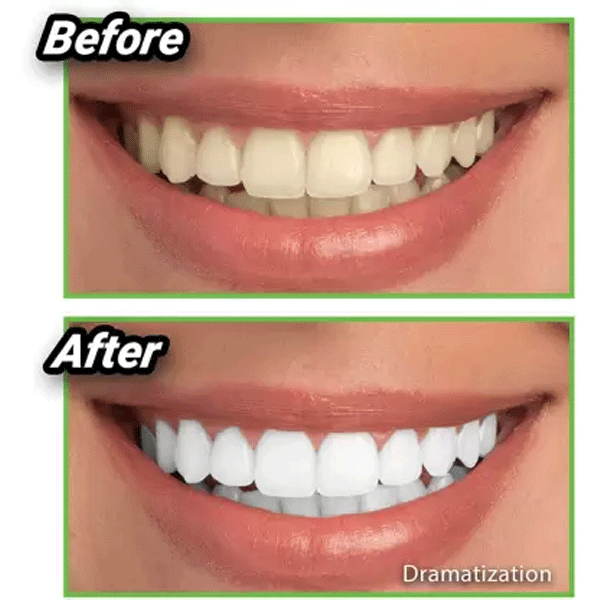 Hot Selling Miracle Teeth Whitener-9669